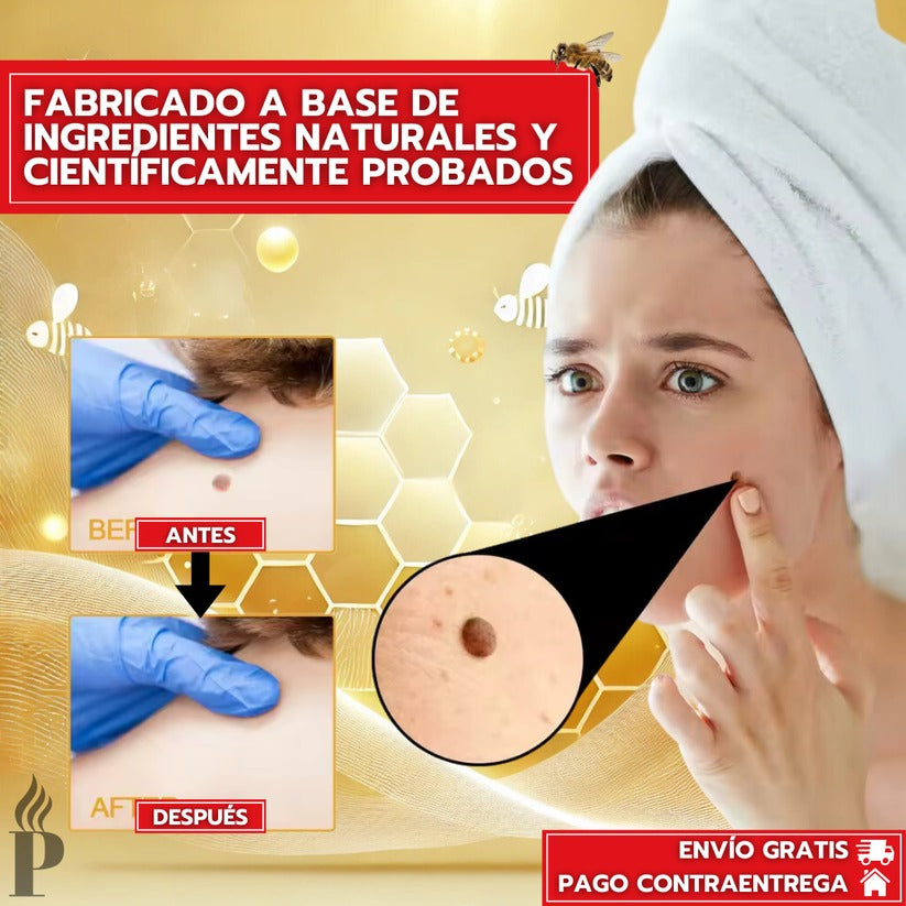 Tag Recede Removedor de verrugas