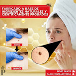 Tag Recede Removedor de verrugas