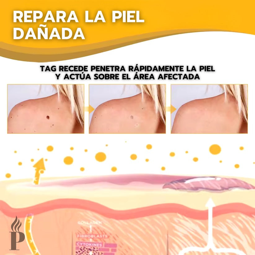 Tag Recede Removedor de verrugas