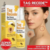 Tag Recede Removedor de verrugas
